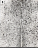 Authentic Light Grey & White Salt Pepper Cowhide Area Rug – Genuine Natural Leather Accent Mat